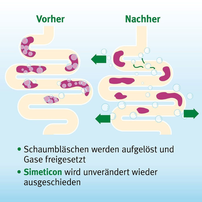 Espumisan Kautabletten bei Blähungen und Völlegefühl, 50 pc Tablettes
